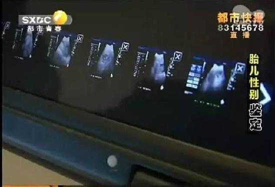 北京中国有供卵试管吗,北京2021年代怀女联系方式,无精症可以做试管婴儿吗？无