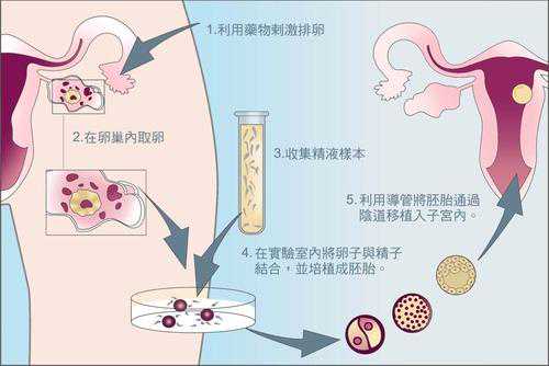 海供卵试管包生男孩,上海瑞金医院生殖科能申请供卵做试管婴儿吗？