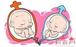 试管婴儿包男孩的国家,国内试管婴儿包生男孩大龄不孕不孕夫妻的必要检查